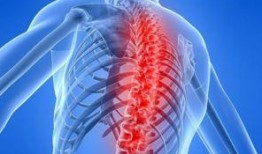 得强直性脊柱炎的明星